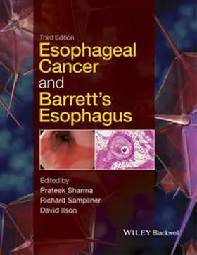 Sharma / Sampliner / Ilson |  Esophageal Cancer and Barrett's Esophagus | eBook | Sack Fachmedien
