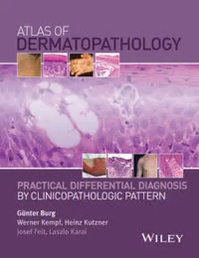 Burg / Kempf / Kutzner |  Atlas of Dermatopathology | eBook | Sack Fachmedien