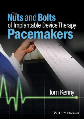 Kenny |  The Nuts and Bolts of Implantable Device Therapy | Buch |  Sack Fachmedien