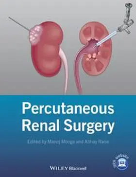 Monga / Rane |  Percutaneous Renal Surgery | eBook | Sack Fachmedien