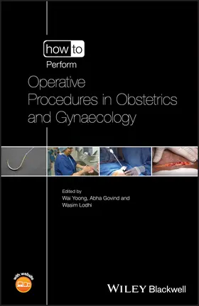 Yoong / Lodhi / Govind |  How to Perform Operative Procedures in Obstetrics and Gynaecology | Buch |  Sack Fachmedien