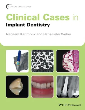 Karimbux / Weber |  Clinical Cases in Implant Dentistry | Buch |  Sack Fachmedien