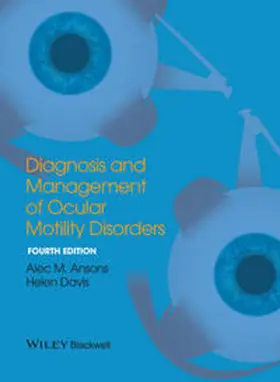 Ansons / Davis |  Diagnosis and Management of Ocular Motility Disorders | eBook | Sack Fachmedien