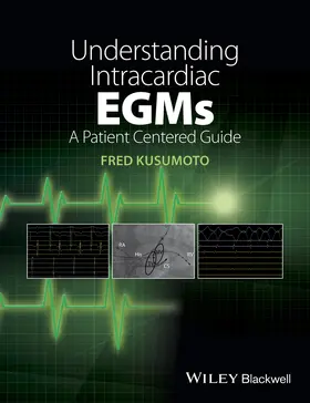 Kusumoto |  Understanding Intracardiac Egms | Buch |  Sack Fachmedien