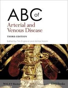 England / Nasim |  ABC of Arterial and Venous Disease | eBook | Sack Fachmedien