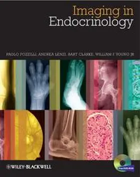 Pozzilli / Lenzi / Clarke |  Imaging in Endocrinology | eBook | Sack Fachmedien