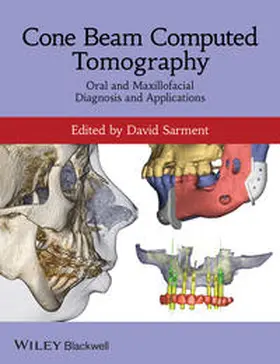 Sarment |  Cone Beam Computed Tomography | eBook | Sack Fachmedien