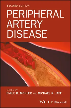 Mohler / Jaff |  Peripheral Artery Disease | Buch |  Sack Fachmedien