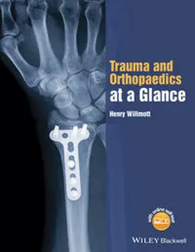 Willmott |  Trauma and Orthopaedics at a Glance | eBook | Sack Fachmedien