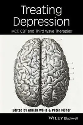Wells / Fisher | Treating Depression | E-Book | sack.de