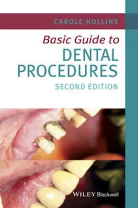 Hollins |  Basic Guide to Dental Procedures | eBook | Sack Fachmedien