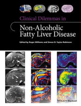 Williams / Taylor-Robinson |  Clinical Dilemmas in Non-Alcoholic Fatty Liver Disease | eBook | Sack Fachmedien