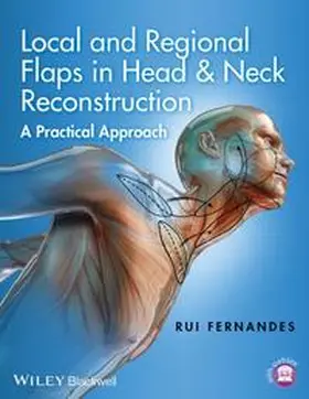 Fernandes |  Local and Regional Flaps in Head and Neck Reconstruction | eBook | Sack Fachmedien
