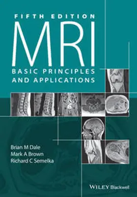 Dale / Brown / Semelka |  MRI | eBook | Sack Fachmedien