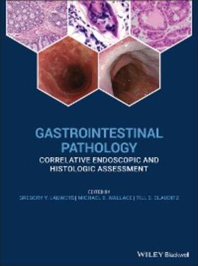 Lauwers / Wallace / Clauditz |  Gastrointestinal Pathology | eBook | Sack Fachmedien