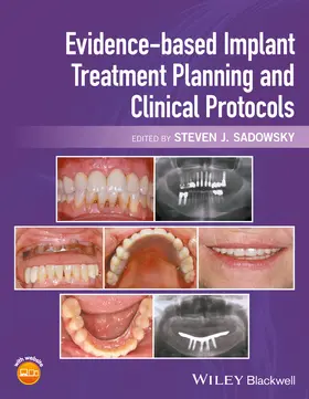 Sadowsky | Evidence-Based Implant Treatment Planning and Clinical Protocols | Buch | 978-1-119-08003-9 | sack.de