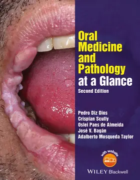 Diz Dios / Scully / Paes de Almeida |  Oral Medicine and Pathology at a Glance | Buch |  Sack Fachmedien