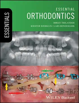 Thilander / Bjerklin / Bondemark | Essential Orthodontics | Buch | 978-1-119-16567-5 | www2.sack.de