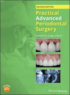 Dibart |  Practical Advanced Periodontal Surgery | Buch |  Sack Fachmedien