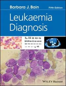 Bain |  Leukaemia Diagnosis | eBook | Sack Fachmedien