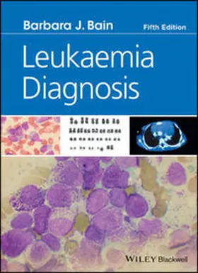 Bain |  Leukaemia Diagnosis | eBook | Sack Fachmedien