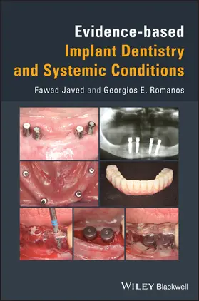 Javed / Romanos | Evidence-Based Implant Dentistry and Systemic Conditions | Buch | 978-1-119-21224-9 | sack.de