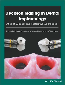 Tosta / de Moura Filho / Chambrone |  Decision Making in Dental Implantology | Buch |  Sack Fachmedien