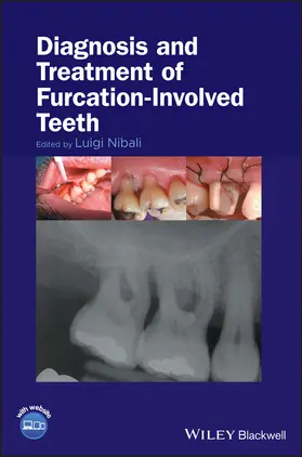 Nibali |  Diagnosis and Treatment of Furcation-Involved Teeth | Buch |  Sack Fachmedien