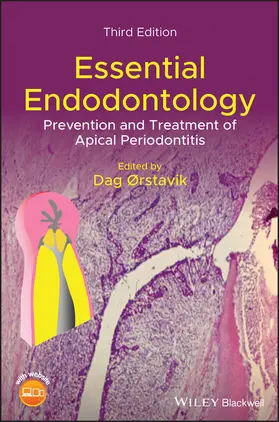 Orstavik |  Essential Endodontology | Buch |  Sack Fachmedien