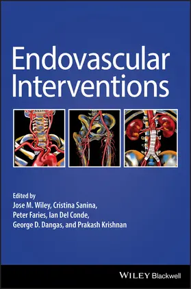 Wiley / Sanina / Faries |  Endovascular Interventions | Buch |  Sack Fachmedien