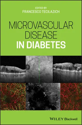 Tecilazich |  Microvascular Disease in Diabetes | Buch |  Sack Fachmedien