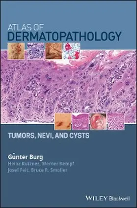 Burg / Kutzner / Kempf |  Atlas of Dermatopathology | eBook | Sack Fachmedien