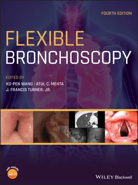 Wang / Mehta / Turner | Flexible Bronchoscopy | Buch | 978-1-119-38905-7 | www2.sack.de