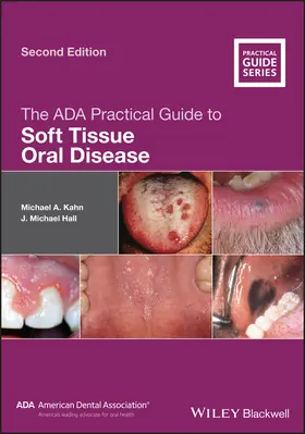 Kahn / Hall | The ADA Practical Guide to Soft Tissue Oral Disease | Buch | 978-1-119-43733-8 | www2.sack.de