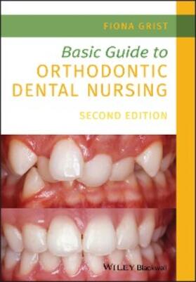 Grist |  Basic Guide to Orthodontic Dental Nursing | eBook | Sack Fachmedien