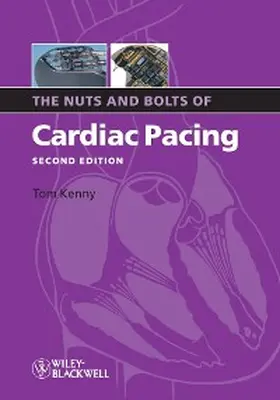 Kenny |  The Nuts and Bolts of Cardiac Pacing | eBook | Sack Fachmedien