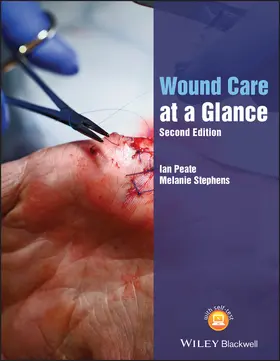 Peate / Stephens |  Wound Care at a Glance | Buch |  Sack Fachmedien