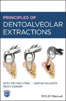 Delpachitra / Sklavos / Kumar |  Principles of Dentoalveolar Extractions | eBook | Sack Fachmedien