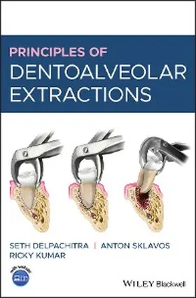 Delpachitra / Sklavos / Kumar |  Principles of Dentoalveolar Extractions | eBook | Sack Fachmedien