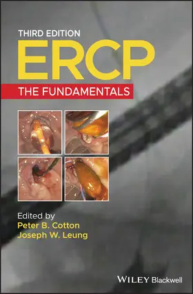 Cotton / Leung |  Ercp | Buch |  Sack Fachmedien