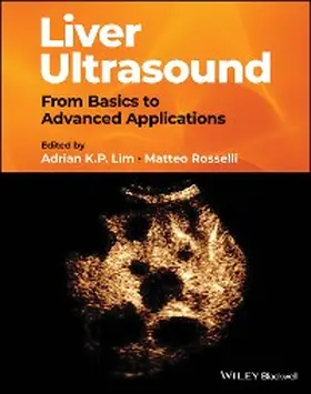 Lim / Rosselli |  Liver Ultrasound | eBook | Sack Fachmedien