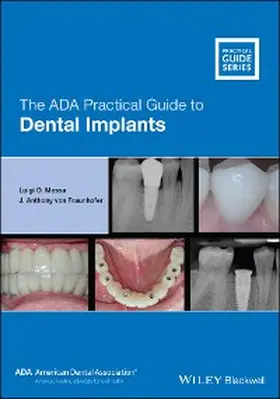 Massa / Fraunhofer |  The ADA Practical Guide to Dental Implants | eBook | Sack Fachmedien