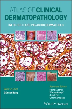  Atlas of Clinical Dermatopathology | Buch |  Sack Fachmedien