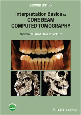 Gonzalez |  Interpretation Basics of Cone Beam Computed Tomography | Buch |  Sack Fachmedien