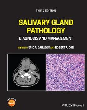 Carlson / Ord | Salivary Gland Pathology | E-Book | sack.de