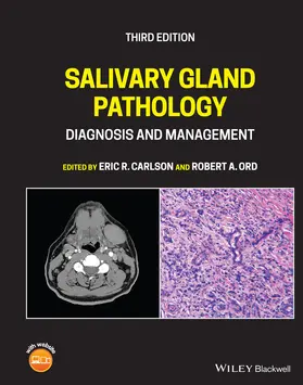 Carlson / Ord | Salivary Gland Pathology | Buch | 978-1-119-73018-7 | sack.de