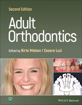 Melsen / Luzi |  Adult Orthodontics | Buch |  Sack Fachmedien