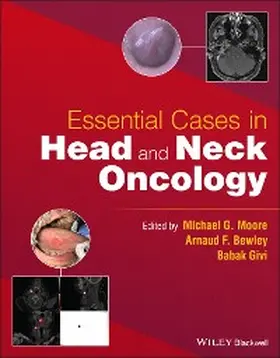 Moore / Bewley / Givi |  Essential Cases in Head and Neck Oncology | eBook | Sack Fachmedien