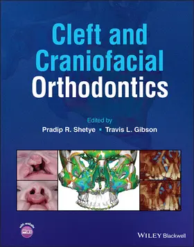 Shetye / Gibson |  Cleft and Craniofacial Orthodontics | Buch |  Sack Fachmedien