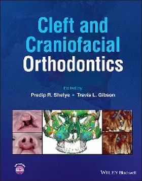 Shetye / Gibson | Cleft and Craniofacial Orthodontics | E-Book | www2.sack.de